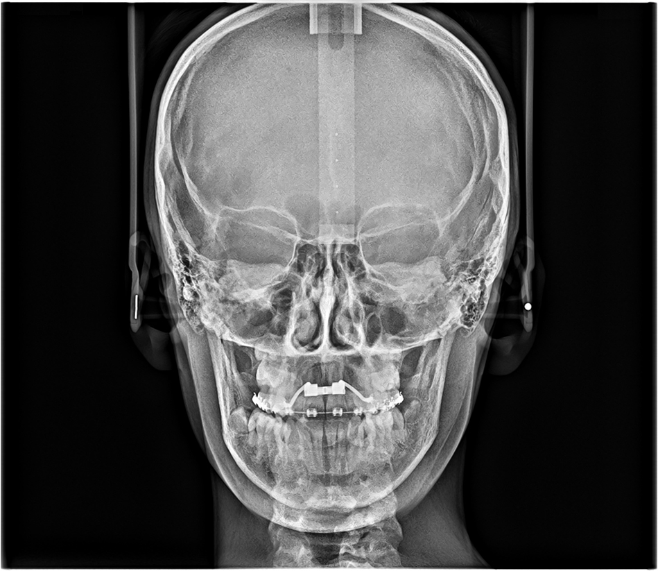 ceph-image-3