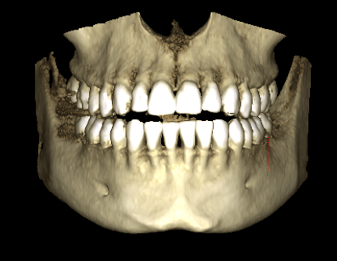 skull